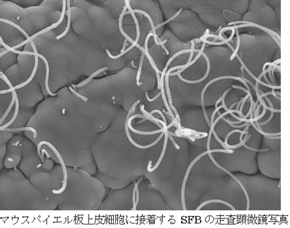 セグメント細菌（segment filamentous bacteria）